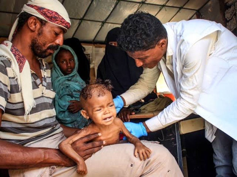 Food affordability in conflict-torn Yemen in light of the Ukraine war 2023