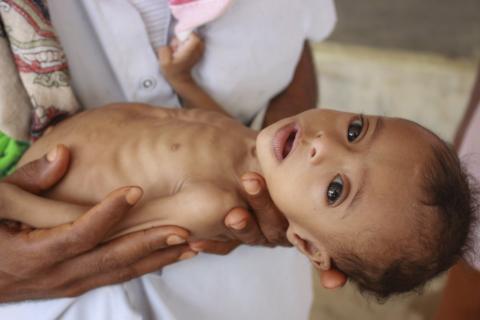 Coronavirus: Hand washing a luxury Yemenis can't afford