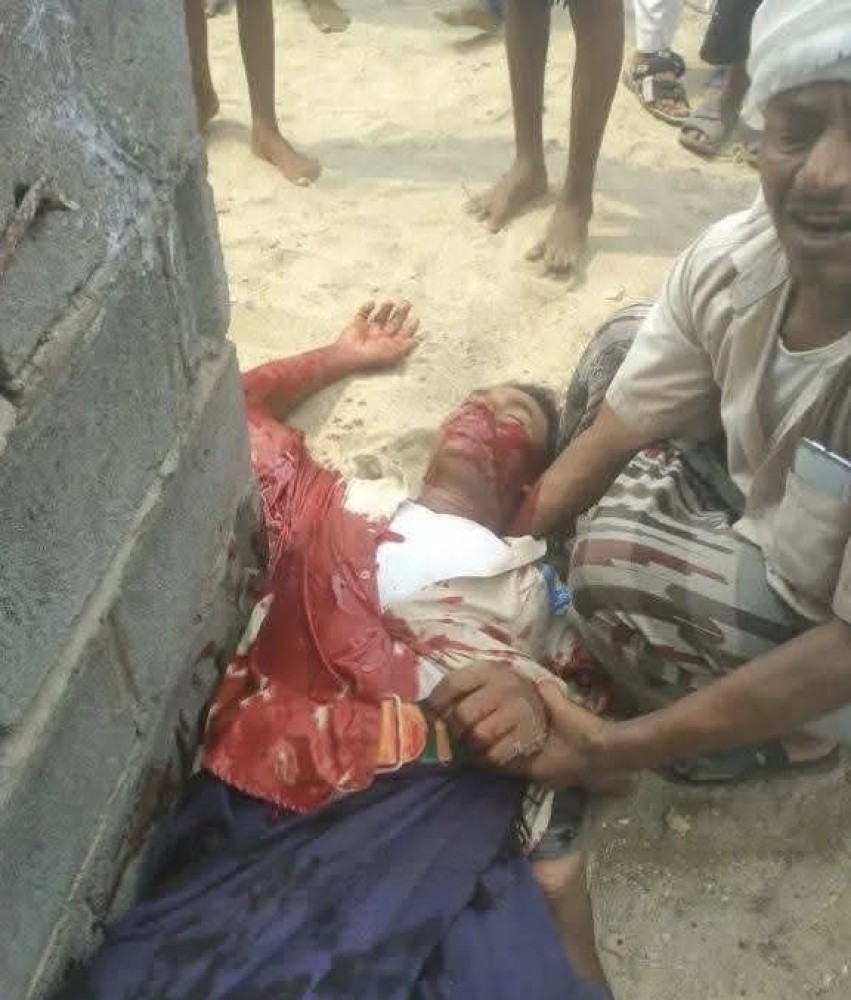 Houthi Gunman Kills Unarmed Displaced Man While Receiving Aid in Hodeidah West of Yemen